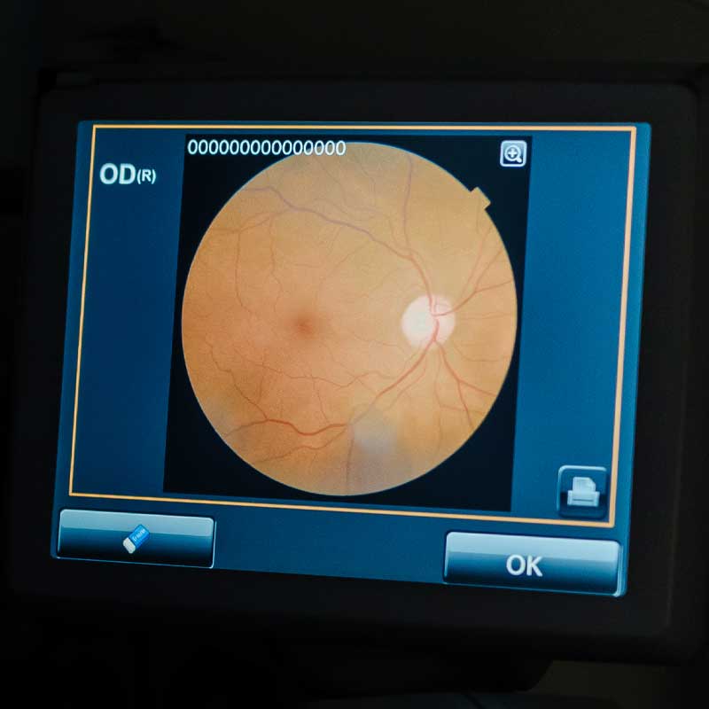 Pruebas Optika Pruebas Optika